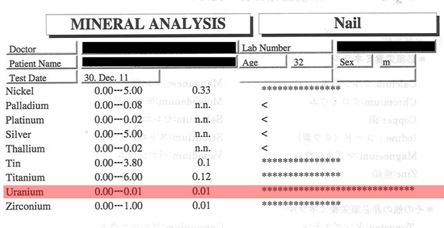 爪ミネラル検査結果1